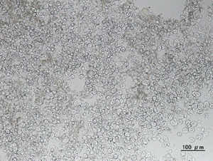 澱粉的電子顕微鏡照片